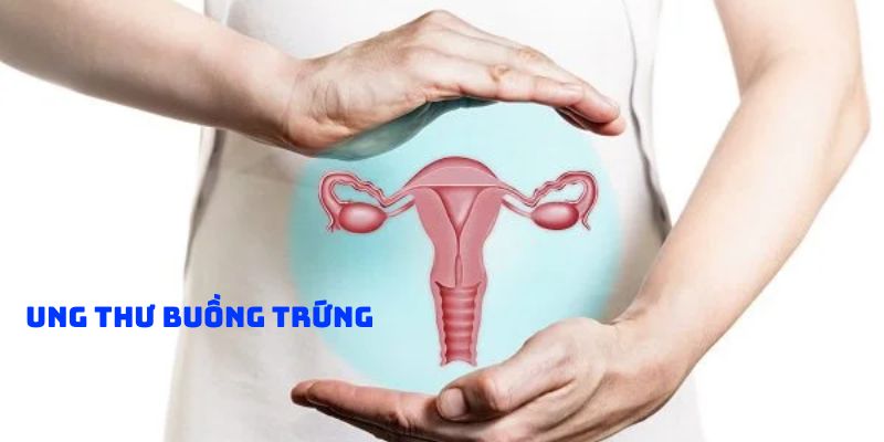 Ung thư buồng trứng loại ung thư nguy hiểm nhất ở phụ nữ
