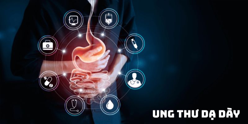 Ung thư dạ dày: Hiểu biết toàn diện, phòng ngừa và điều trị