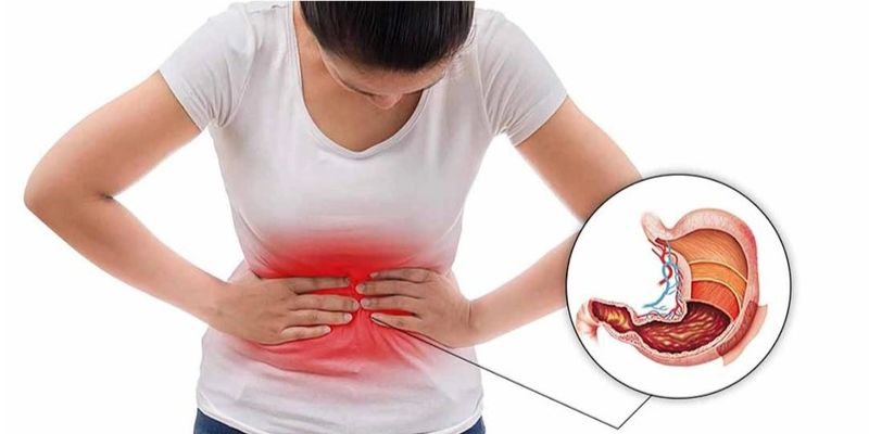 Làm thế nào để chẩn đoán ung thư dạ dày?