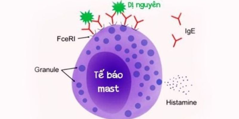 Ung thư tế bào mast (Mastocytosis)