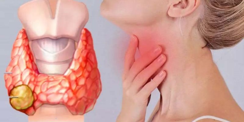 Những ai có nguy cơ cao mắc ung thư tuyến giáp?