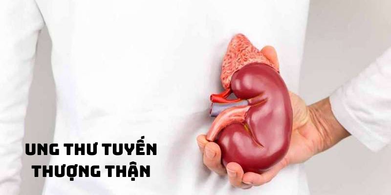 Ung thư tuyến thượng thận phòng ngừa và điều trị toàn diện